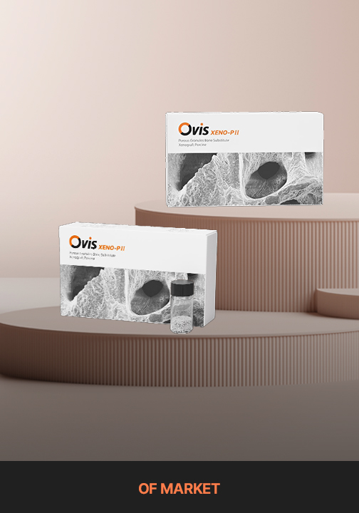 신제품 OVIS XENO-PⅡ를 소개합니다! 지금 바로 만나보세요 :)